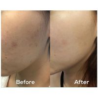 کرم ضد لک اکسیس وای مدل Glow Serum حجم 50 میلی لیتر 2